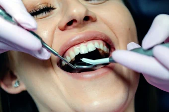Плазмолифтинг для лечения десен в стоматологии в Москве