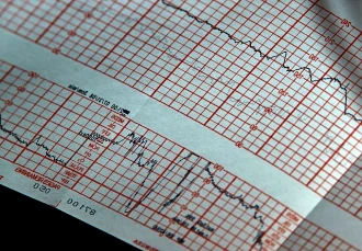 Процедура электрокардиограммы при проблемах с сердцем