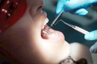 Лечение пульпита зуба у взрослых и детей